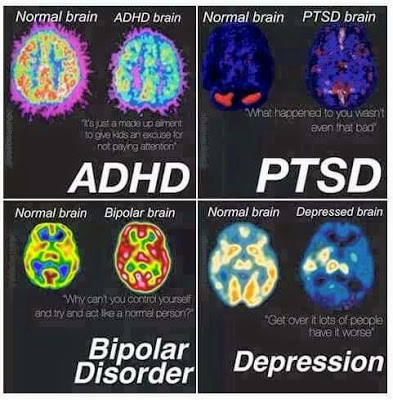 PTSD, Anxiety, The Brain, And Your Role